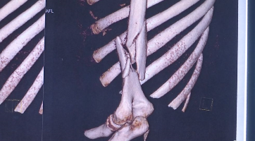 微信截图_20190826230124.png 微信截图_20190826230124.png