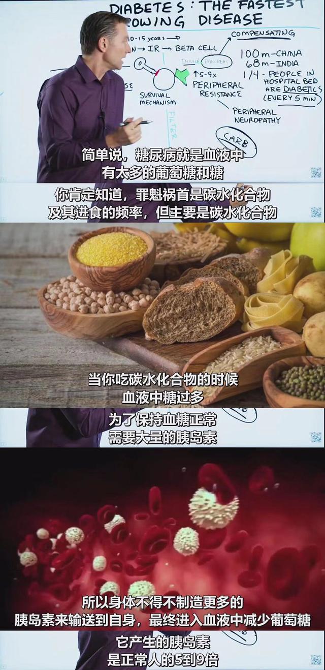 终于有医生说实话了:不吃碳水化合物,就能逆转90%的2型糖尿病
