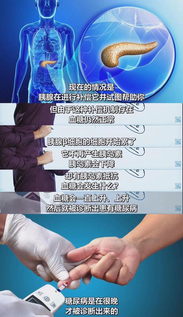 终于有医生说实话了:不吃碳水化合物,就能逆转90%的2型糖尿病