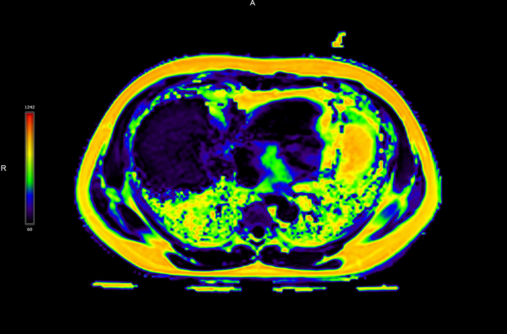 磁共振全面多病种定量临床应用.png 磁共振全面多病种定量临床应用.png