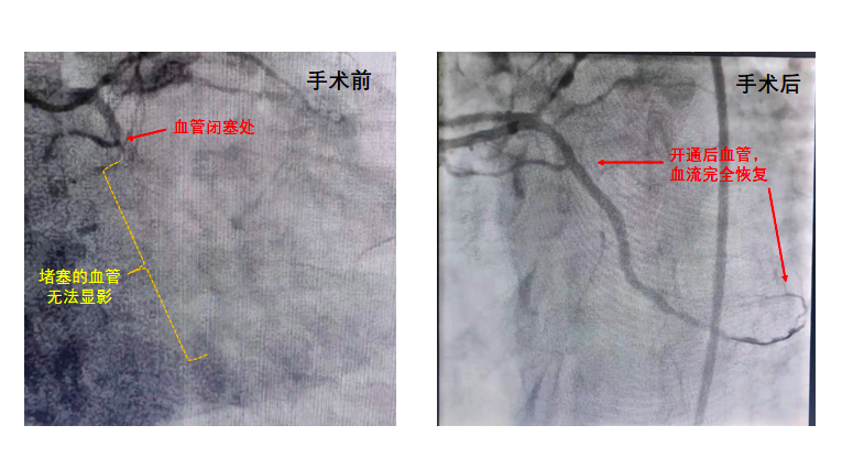 屏幕快照 2022-03-17 下午6.01.58.png 屏幕快照 2022-03-17 下午6.01.58.png