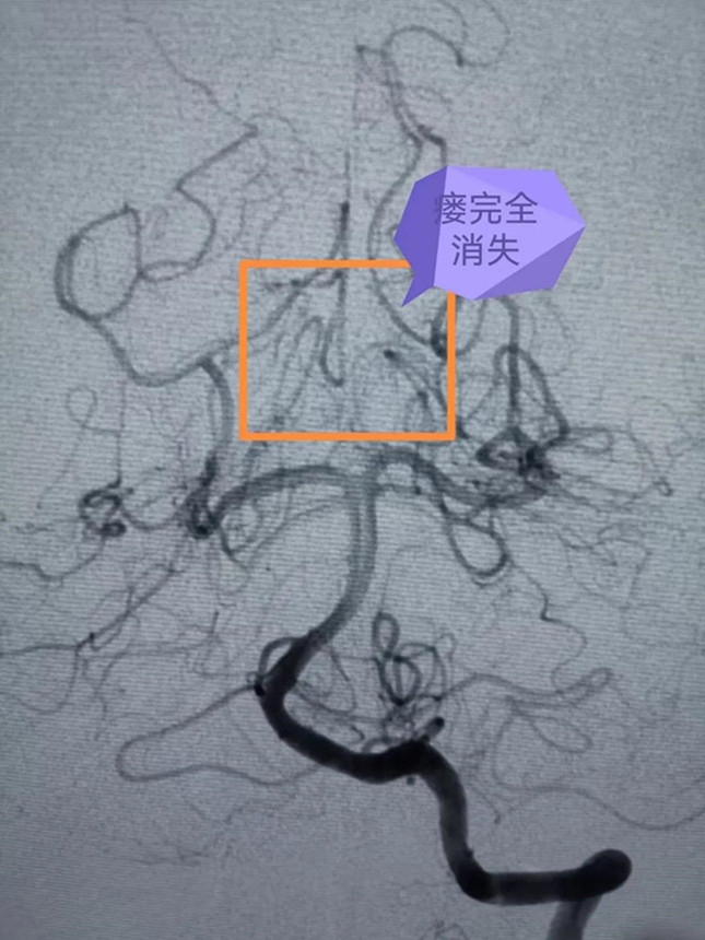 内 06135037_副本.jpg 内 06135037_副本.jpg